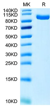Recombinant Human PTK7/CCK4 Protein