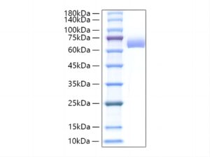 Recombinant Mouse Alkaline phosphatase (Intestinal type)/ALPI Protein