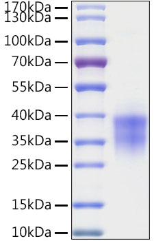 Recombinant Human Granzyme B/CTLA-1/GZMB Protein