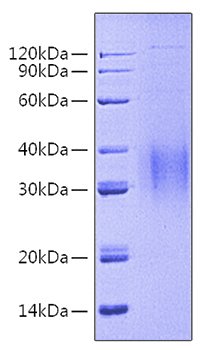 Recombinant Human Siglec-2/CD22 Protein