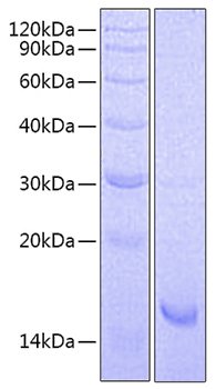 Recombinant Mouse IL-21 Protein