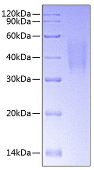 Recombinant Human TNFRSF10C/DcR1/TRAIL-R3/CD263 Protein