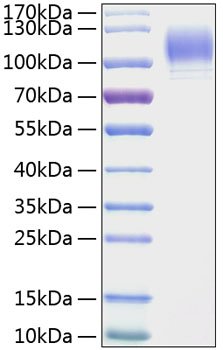 Recombinant Mouse P-Selectin/SELP/CD62P Protein