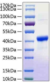 Recombinant Human Serpin B3/SCCA-1 Protein