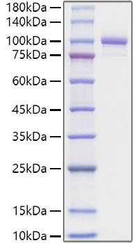 Recombinant Mouse Periostin/PN/POSTN Protein
