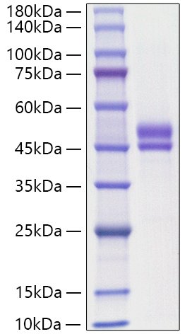 Recombinant Human WFDC2/HE4/WAP5 Protein