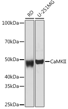 CaMK2 delta/CAMK2 gamma Rabbit mAb