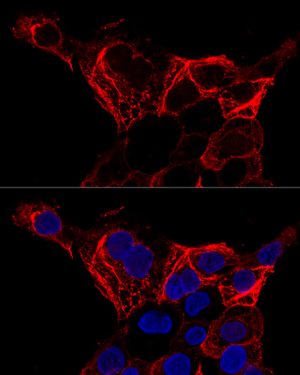 Cytokeratin 20 (KRT20) Rabbit pAb