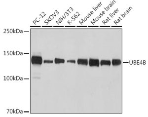 UBE4B Rabbit mAb