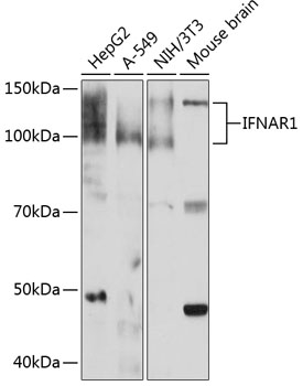 IFNAR1 Rabbit mAb