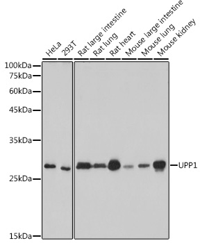 UPP1 Rabbit mAb