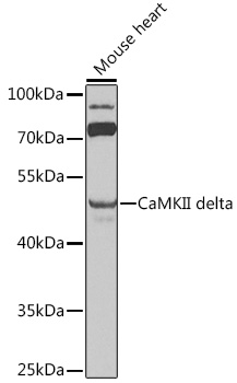 CaMKII delta Rabbit pAb