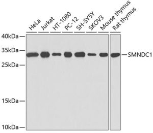 SMNDC1 Rabbit pAb
