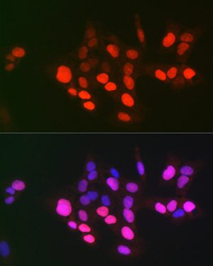 DNA topoisomerase II alpha (TOP2A) Rabbit pAb