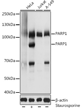 PARP1 Rabbit pAb