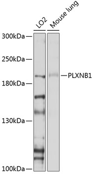 PLXNB1 Rabbit pAb