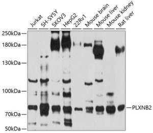 PLXNB2 Rabbit pAb