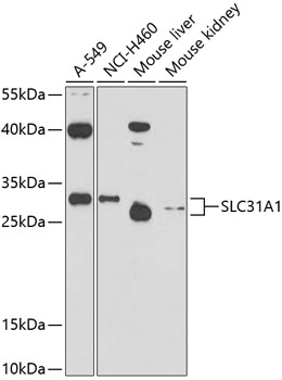 SLC31A1 Rabbit pAb