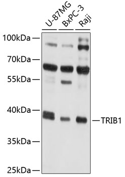 TRIB1 Rabbit pAb