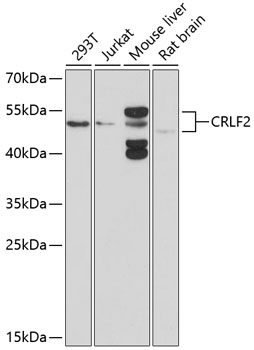 CRLF2 Rabbit pAb