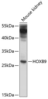 HOXB9 Rabbit pAb