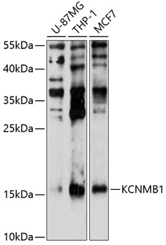 KCNMB1 Rabbit pAb