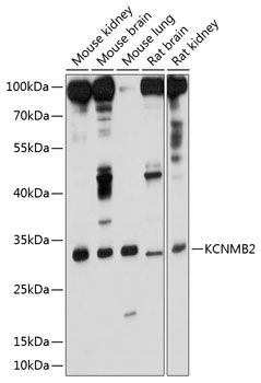 KCNMB2 Rabbit pAb