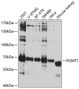 POMT1 Rabbit pAb