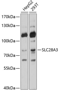 SLC28A3 Rabbit pAb