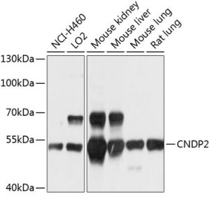 CNDP2 Rabbit pAb