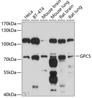 GPC5 Rabbit pAb