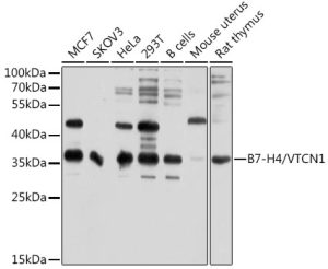 B7-H4/VTCN1 Rabbit pAb