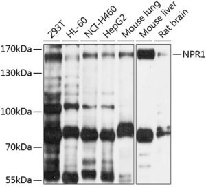 NPR1 Rabbit pAb