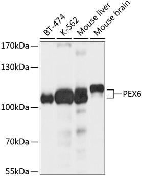 PEX6 Rabbit pAb