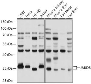JMJD8 Rabbit pAb