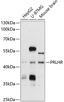 PRLHR Rabbit pAb