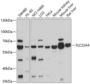 SLC22A4 Rabbit pAb