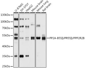 PP2A-B55β/PR55β/PPP2R2B Rabbit pAb