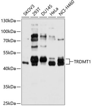 TRDMT1 Rabbit pAb