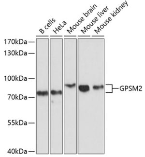 GPSM2 Rabbit pAb