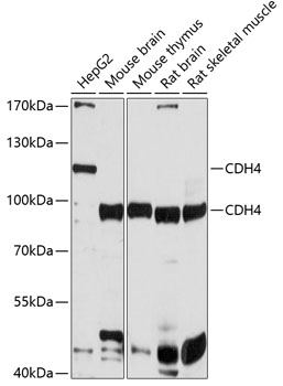 CDH4 Rabbit pAb