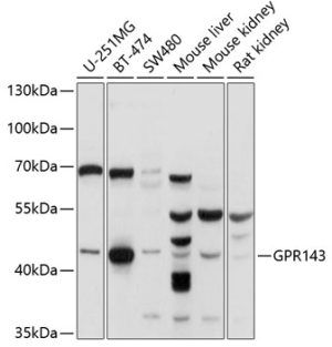 GPR143 Rabbit pAb