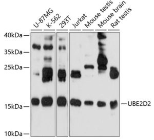 UBE2D2 Rabbit pAb