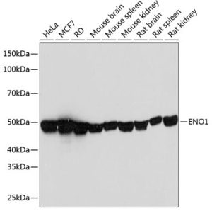 ENO1 Rabbit mAb