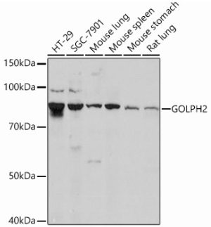 GOLPH2 Rabbit mAb