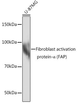 Fibroblast activation protein-α (FAP) Rabbit mAb