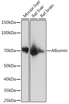 Albumin Rabbit mAb
