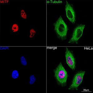 MITF Rabbit mAb