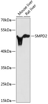 SMPD2 Rabbit pAb