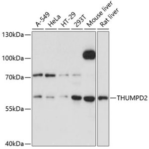 THUMPD2 Rabbit pAb